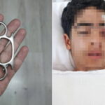 Esenyurt’ta 15 Yaşındaki Çocuğa Akranından Muşta ile Saldırı: Sağlığı Tehlikede!